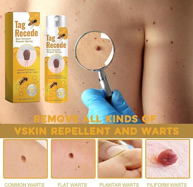 Last Day Of Discount 🔥  Bee Venom Wart Remover Spray