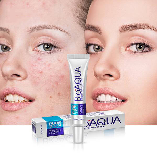 LAST DAY OF DISCOUNT 🔥 BIO AQUA ACNE CLEANSER